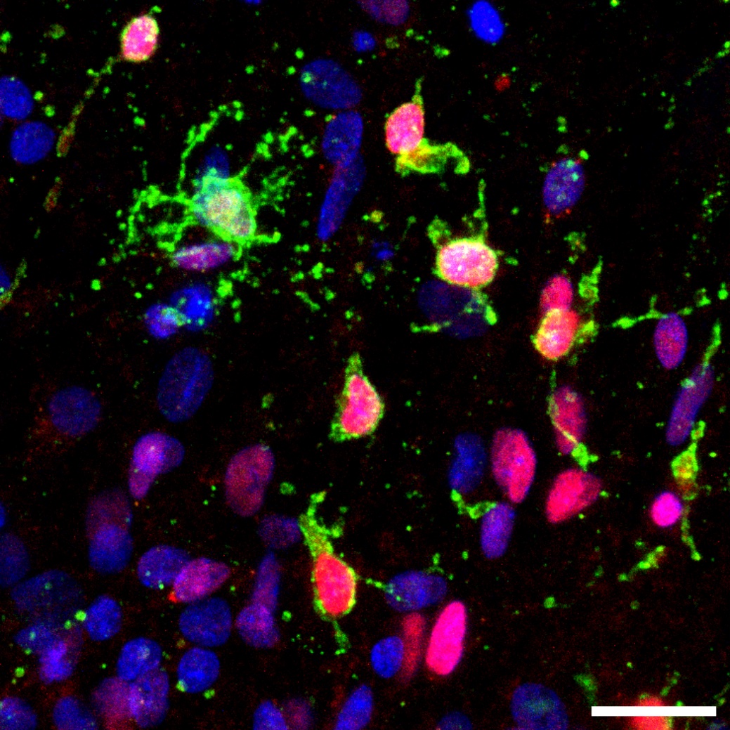 Human oligodendrocytes in a dish (green) produce the amyloid beta protein which is implicated in Alzheimer's.