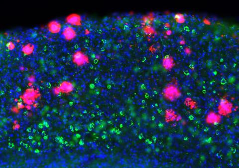 Plaques and tangles in cortex in vitro
