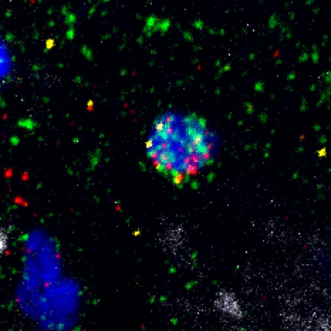 An oligodendrocyte in post-mortem human brain tissue (blue cell with green spots) expresses the genes (red and yellow spots) required to produce the amyloid beta protein which is implicated in Alzheimer's.