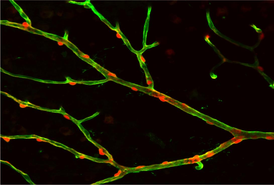 Blood vessels